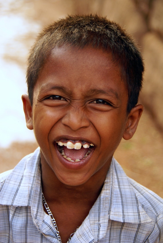 Petit garçon éclate de rire en montrant ses dents - Badami